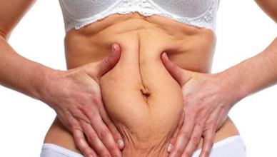 Si të hiqni stomakun: rregullat bazë, këshilla, veçori dhe ushtrime Si të shtrëngoni stomakun në një javë